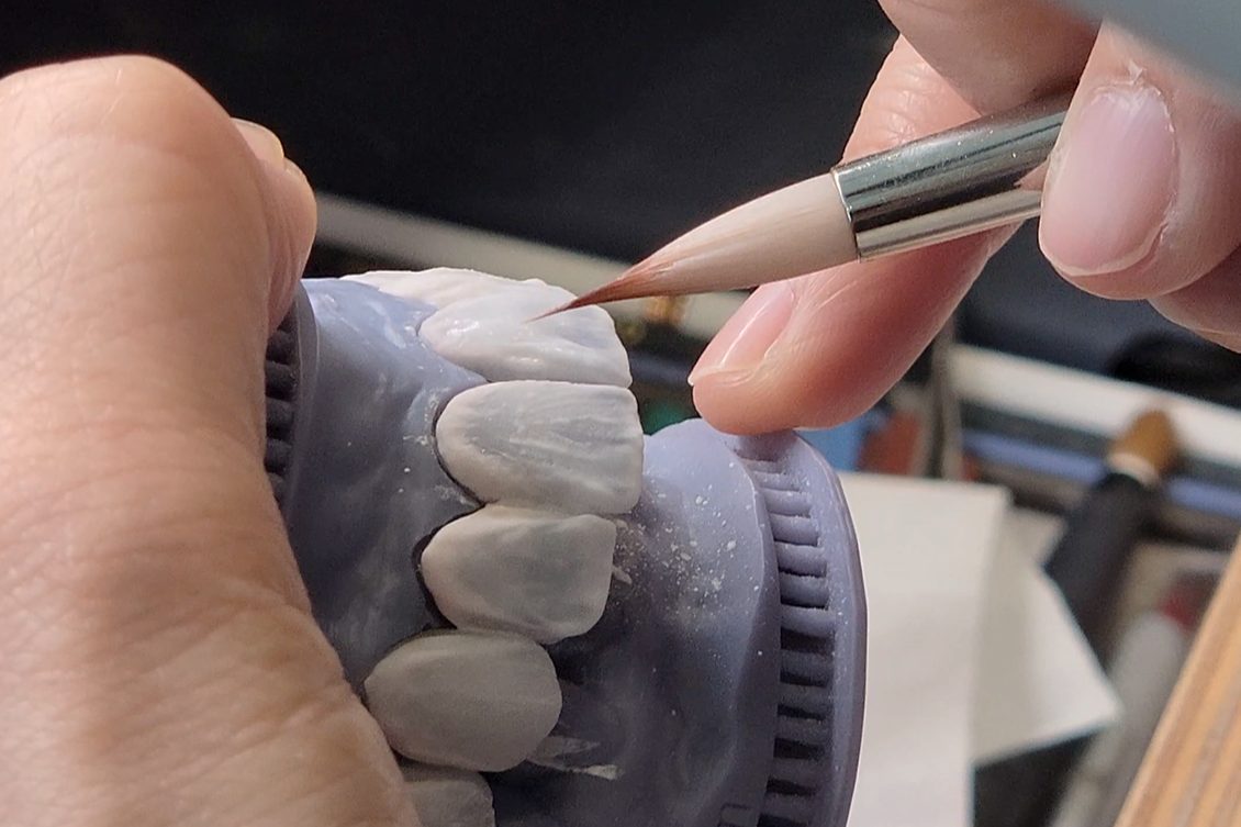 Handmade ceramic detail for full mouth rehabilitation, Dr. Fabbro Dubai