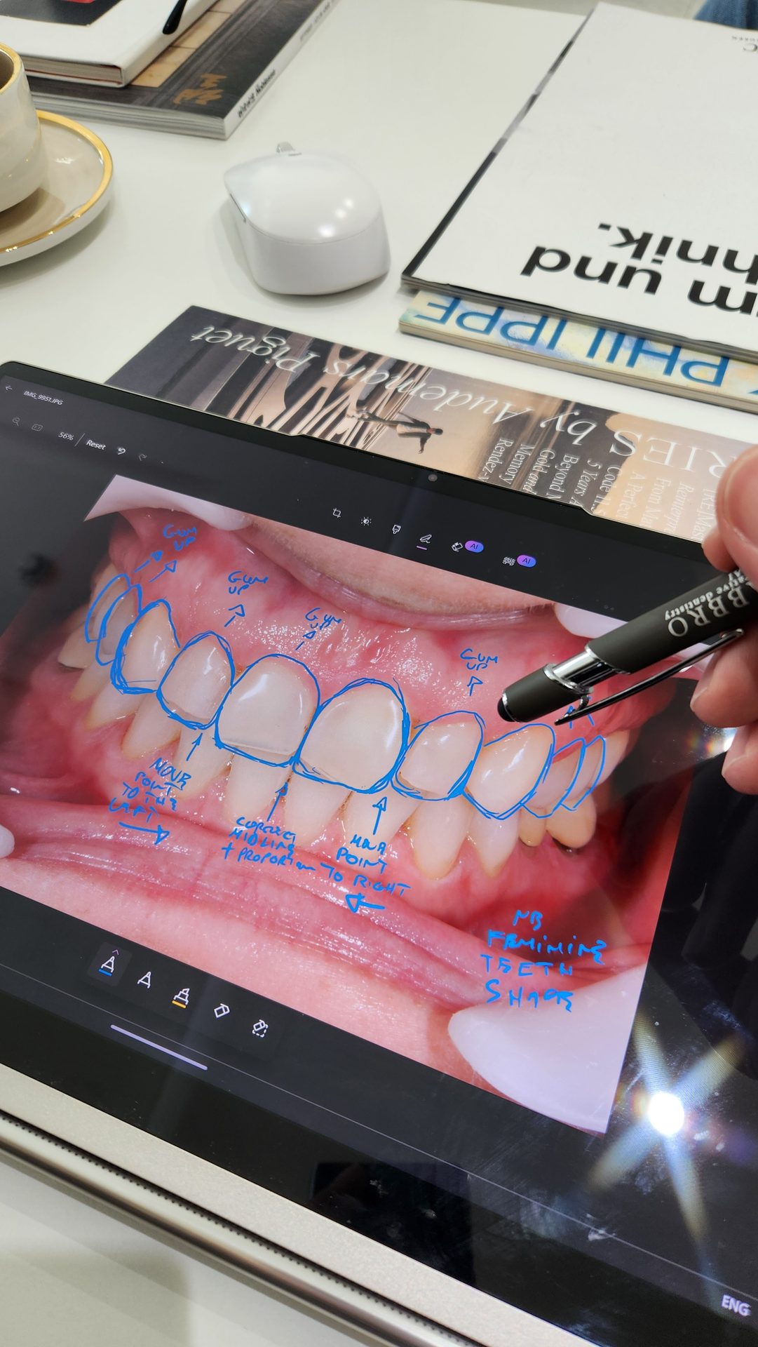 The Fabbro method, a smile proportion study, model and hand at work
